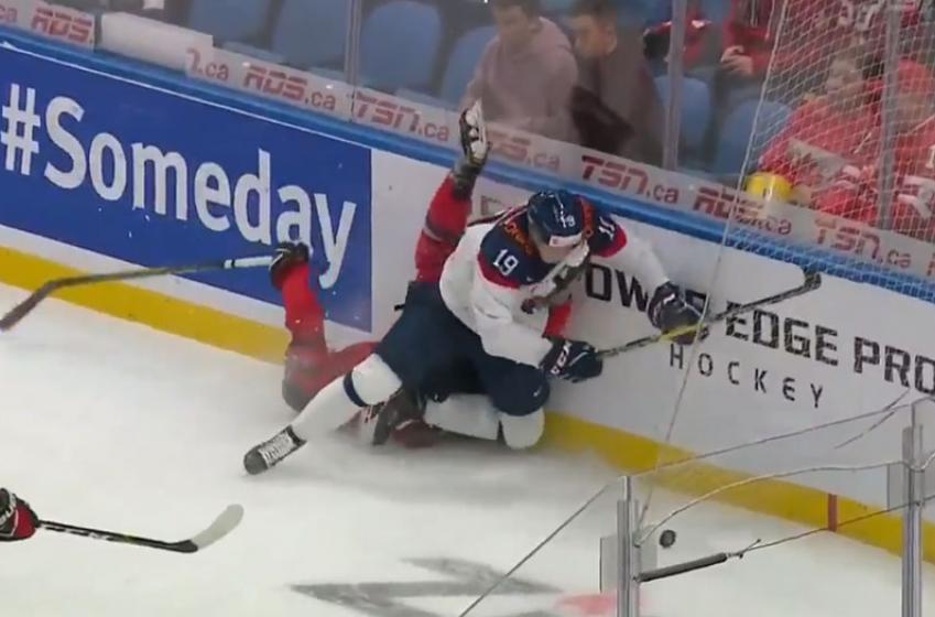 Un joueur reçoit un patin au visage dans le match Canada - Slovaquie!